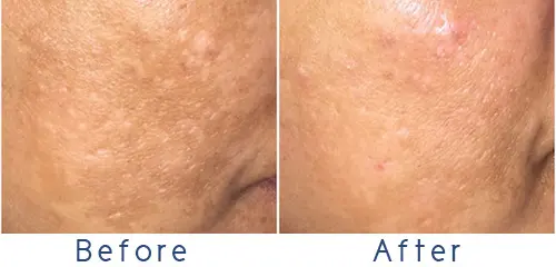 DualMax IPL - Image 3